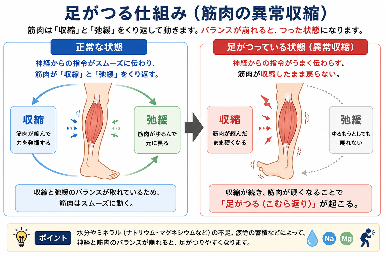 足がつる仕組み 筋肉の異常収縮